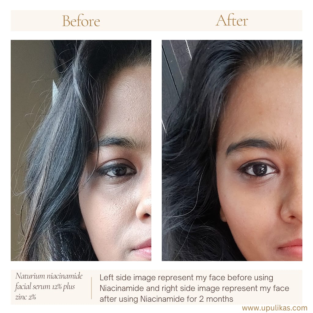 Neutral Before and After Instagram Post 2